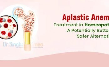 Aplastic Anemia Treatment in Homeopathy