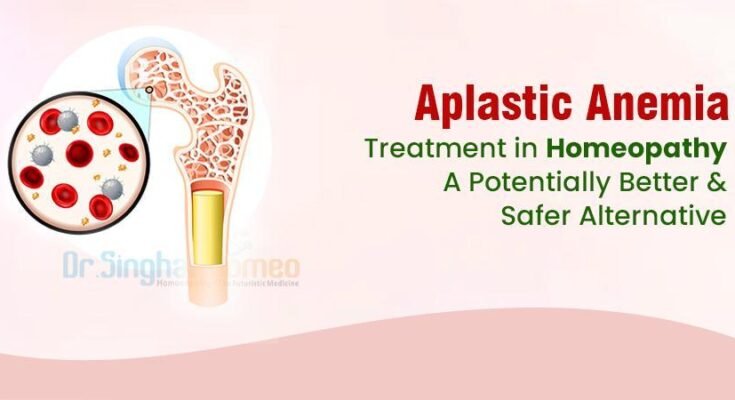 Aplastic Anemia Treatment in Homeopathy