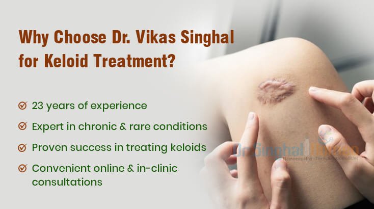Best Doctor for Keloid Treatment